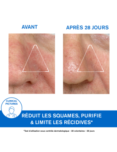 Uriage D.S. Émulsion 40 ml