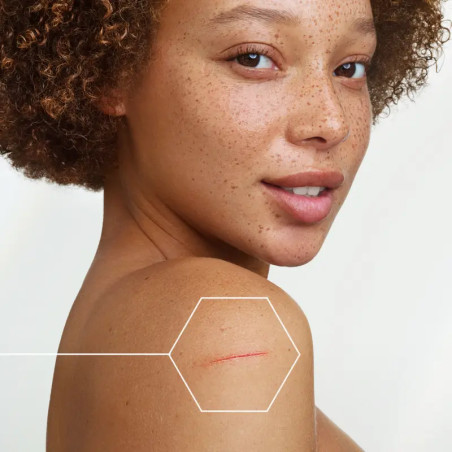 A-Derma - Epitheliale A.H Ultra – Crème Ultra-Réparatrice